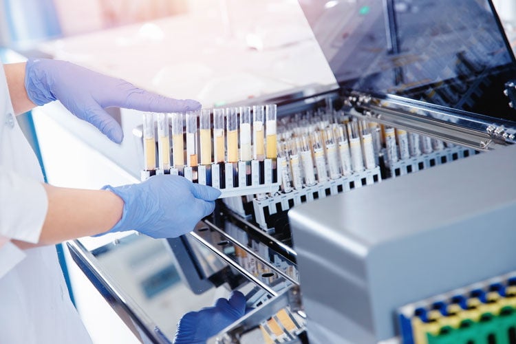 Medical equipment, Automation, Laboratory NSK linear motion solutions for diagnostic and laboratory equipment