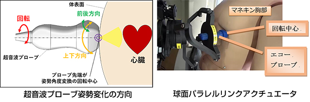 超音波プローブ姿勢変化の方向/球面パラレルリンクアクチュエータ使用イメージ